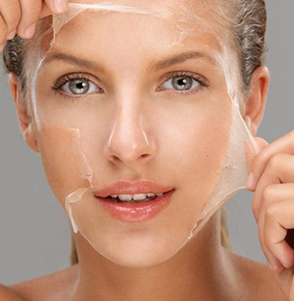 Peeling químico